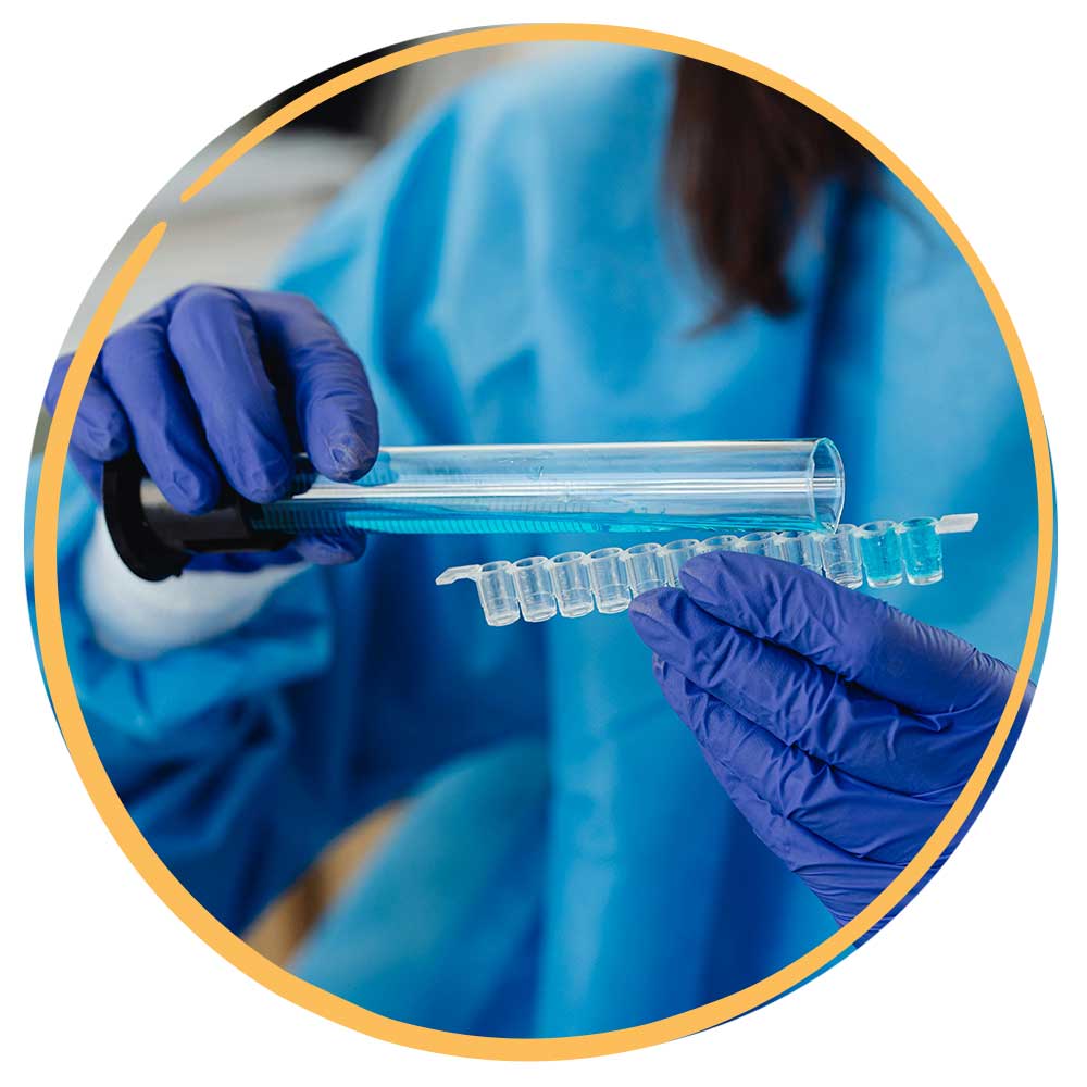 Person in scrubs and blue gloves pouring something from a beaker into a glass container for samples - Medical